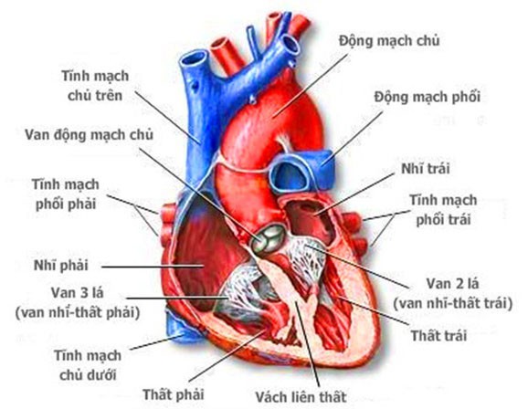 Ảnh 4 của Congenital heart defect